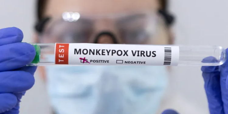 Cegah Virus Cacar Monyet, Pemkot Makassar Buka Posko Pengaduan