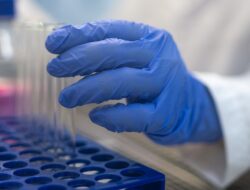 Kembangkan Alat Deteksi Dini Kanker, Peneliti UGM Manfaatkan Dana Riset LPDP