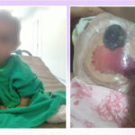 Segera Jalani Operasi Ketiga, Bayi Senja Kembali Butuh Bantuan Dermawan